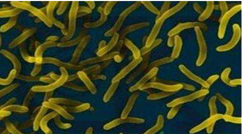 微生物菌劑好？好在哪里您知道嗎？